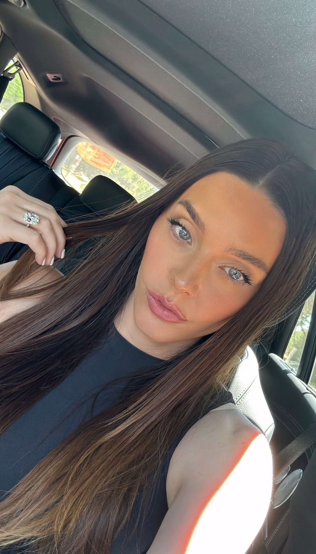 How to Get Rid of Hyperpigmentation Around the Mouth: Pro Tips